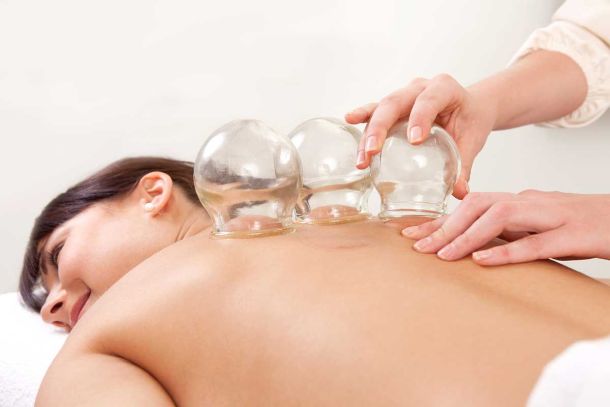 Cupping treatment Kelowna Okanagan