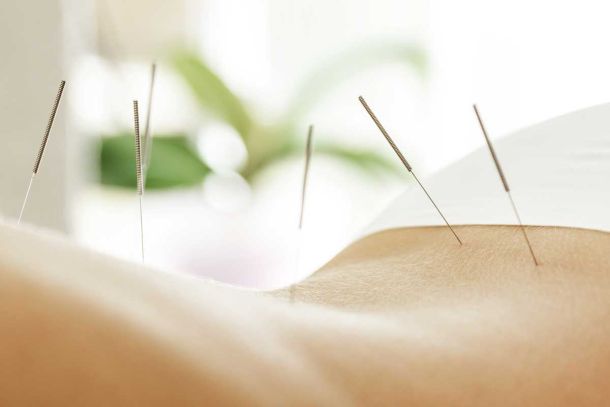 Acupuncture Kelowna